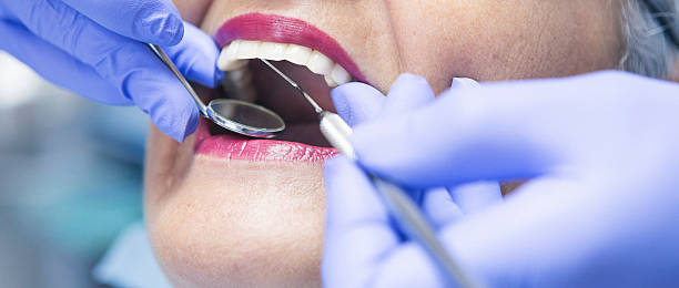 Best Emergency Wisdom Teeth Removal in Reinholds, PA
